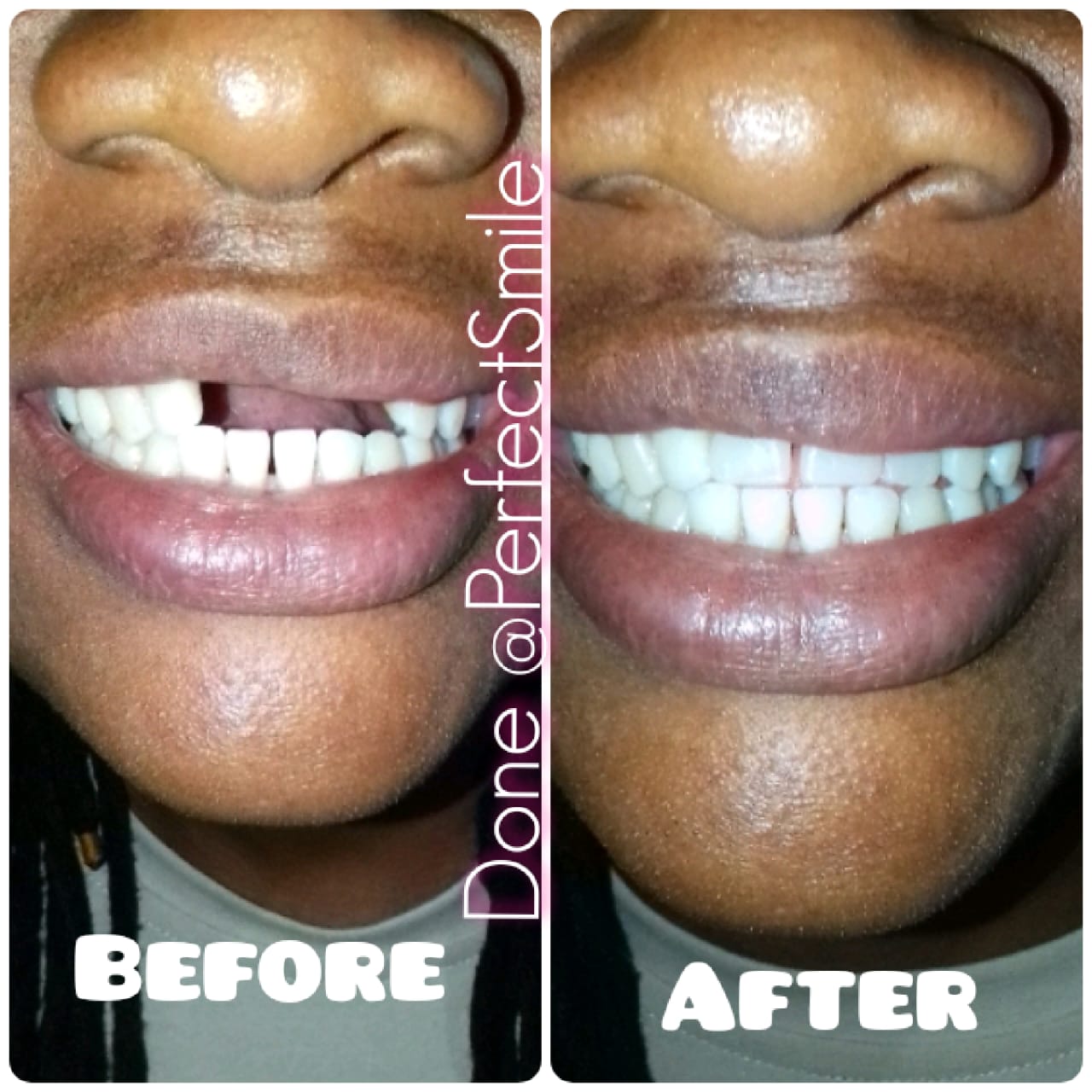 Perfect Smile Dental & Prostheses